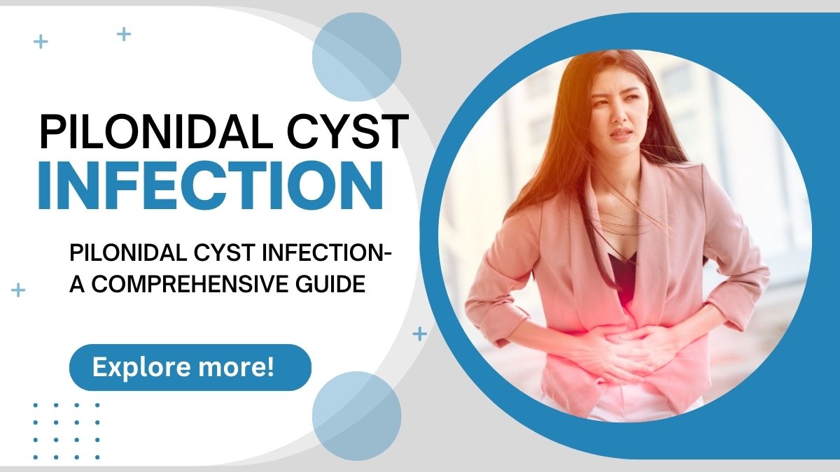 <strong>Pilonidal cyst infection- A comprehensive guide A Comprehensive Guide to Pilonidal Cyst Infection</strong>
